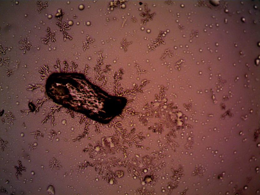 biofilm formation on gut mucosa under microscopic view