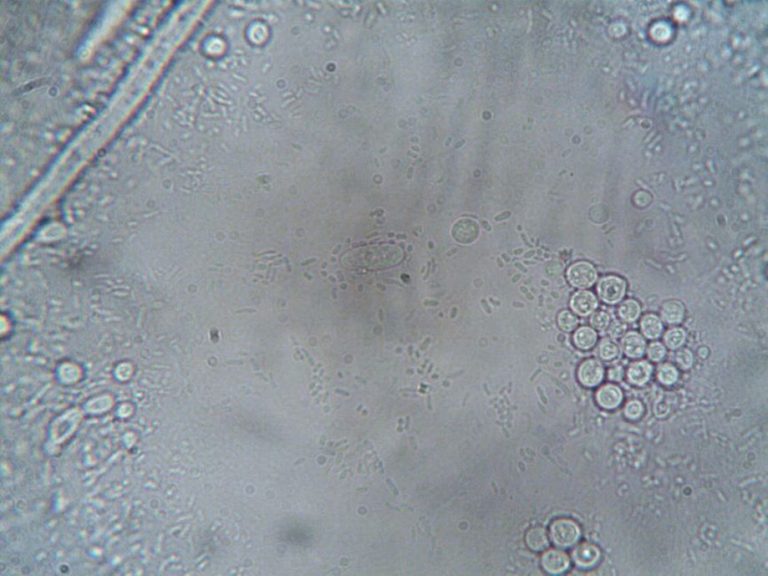 Microscopy image showing tight junctions between intestinal cells