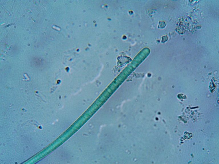 bacterial biofilm structure under microscope in the small intestine