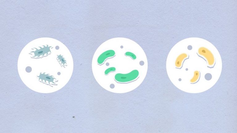 diagram showing bacterial overgrowth in small intestine